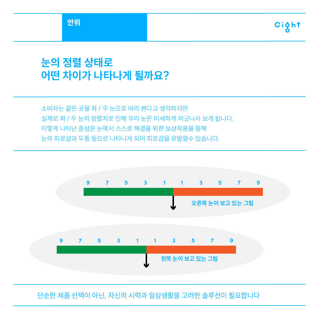 눈의 정렬 상태에 따른 좌우 시선 차이