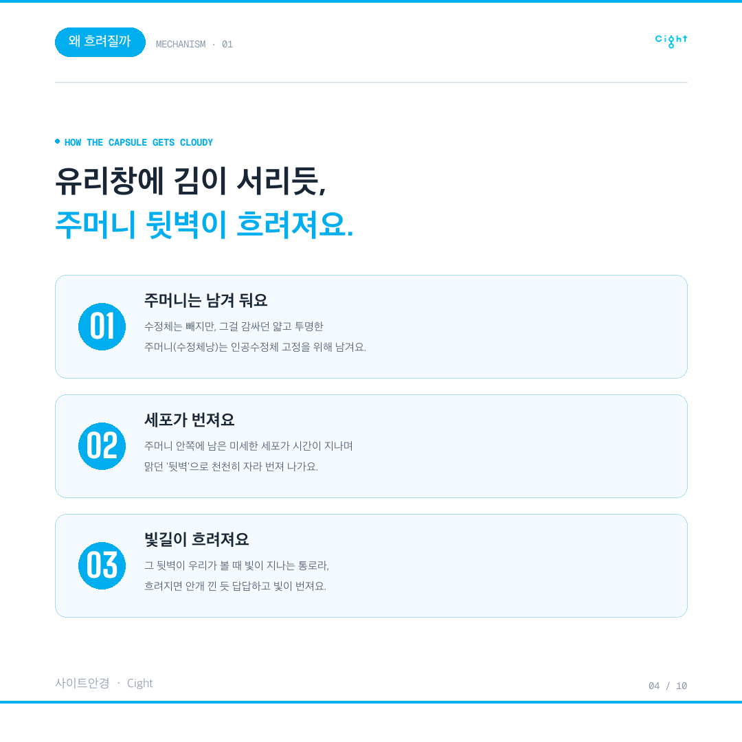 후낭혼탁이 생기는 원리