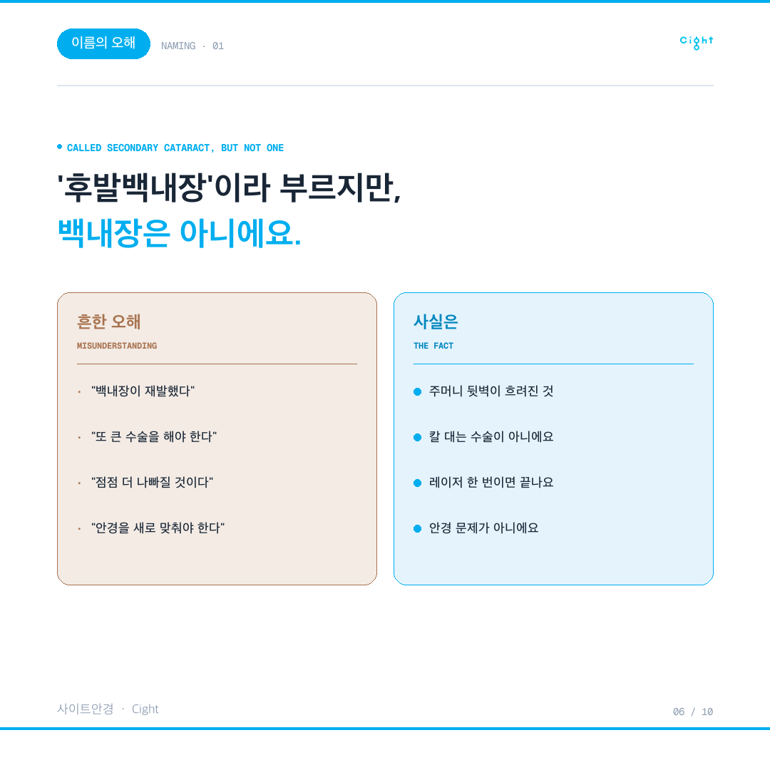 후발백내장이라는 이름의 오해