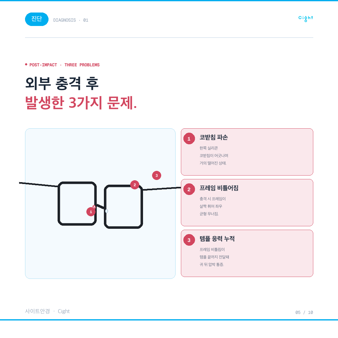 일본에서 산 금자안경, 한국에서 AS가 될까 — 코받침 파손과 비틀어짐을 되살린 기록