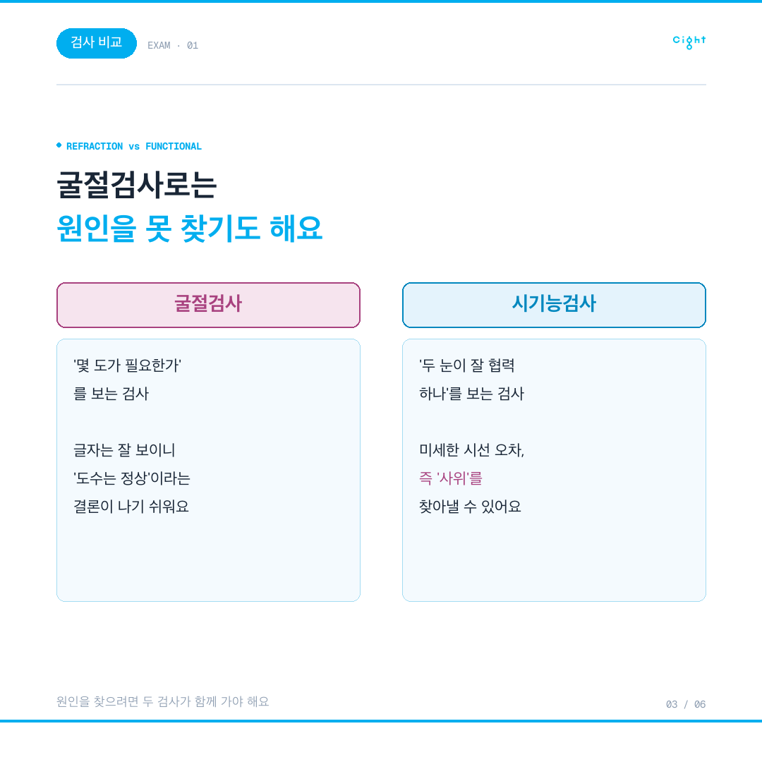 도수는 정상인데 초점이 겉돈다면 — 프리즘 렌즈와 두 눈의 정렬