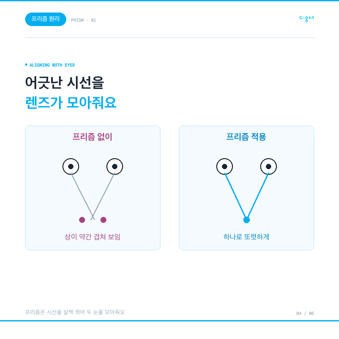 도수는 정상인데 초점이 겉돈다면 — 프리즘 렌즈와 두 눈의 정렬